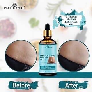 PARK DANIEL Premium Stretch Marks Removal Oil & Even Out Skin Tone Pack of 1 30 ML (30 ml) - Skin Care - Oils and Serums | Buy online on ZillyBuy