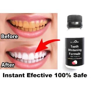 Instant Teeth Whitening Powder To White Your Teeth And Loking Beautifull Smile - Oral Care | Buy online on ZillyBuy